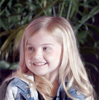 Real Hereditary Factor X Deficiency patient, Hazel